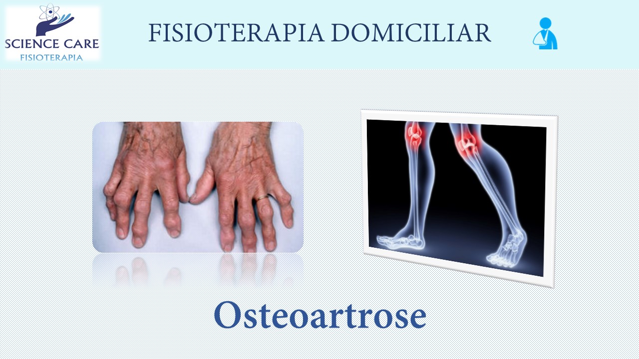 Osteoartrose tratamento domiciliar