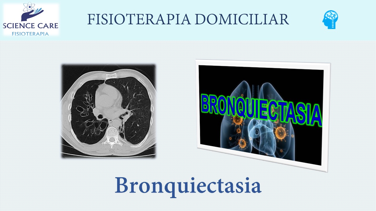 bronquiectasia fisioterapia domiciliar